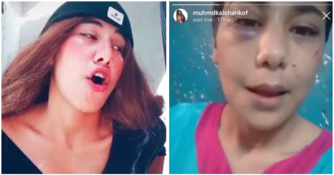 Menna Abdelaziz